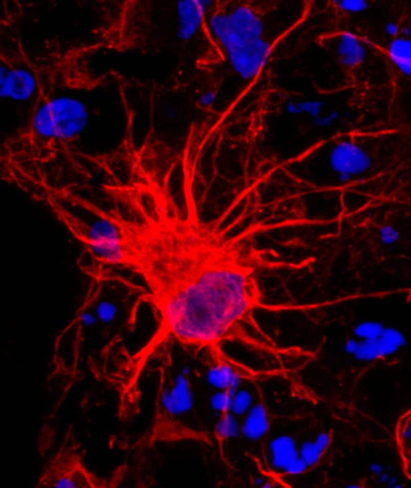 Астроциты мозга. Глиальные клетки фото. Глиальные клетки сателлиты. Астроциты картинки.